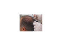 The Canadian Institute of Hair & Scalp Specialists (1) - Alternatīvas veselības aprūpes