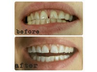 H-Smile Teeth Whitening and Dental Hygiene (2) - Zubní lékař