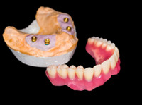 Find crowns dental laboratory - C&P Dental Lab (2) - Tandartsen
