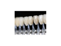 Find crowns dental laboratory - C&P Dental Lab (5) - Οδοντίατροι