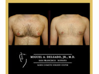 Miguel Delgado, M.D. (3) - Kosmētika ķirurģija
