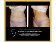 Miguel Delgado, M.D. (8) - Chirurgia plastyczna