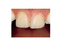 Dental Mammoth (1) - ڈینٹسٹ/دندان ساز