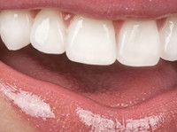 Dentcoat (1) - Zubní lékař