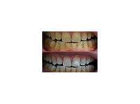 Dentcoat (2) - ڈینٹسٹ/دندان ساز