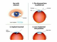 Jehan Eye Clinic (1) - Больницы и Клиники