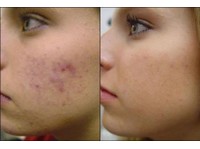 IIAM groups Skin & Laser Clinic (5) - ہاسپٹل اور کلینک