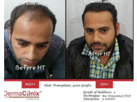 Dermaclinix - The Complete Skin & Hair Solution Center (1) - Beauty Treatments