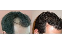 Sizzling Hair Care (3) - Medicina alternativa