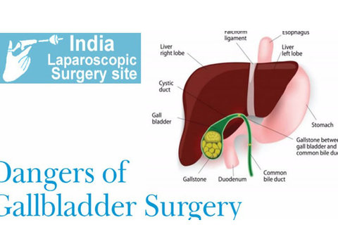 Laparoscopic Gallbladder Surgery Benefits India  - Hospitals & Clinics