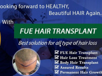 Fue Hair Transplant Clinic in Punjab (3) - Hospitais e Clínicas