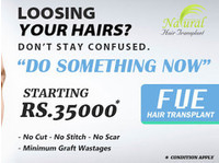 Natural Hair Transplant Chennai (2) - Alternative Healthcare