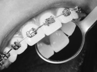 Shields Dental & Implant Clinic Limerick (4) - Зъболекари