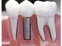 Samaritan Dental (1) - ڈینٹسٹ/دندان ساز