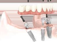 winston omp advanced dental implantology (7) - Dentists