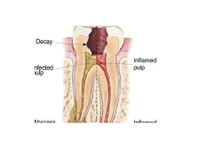 Artident, zobozdravstvene storitve (1) - Dentistas
