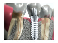 Artident, zobozdravstvene storitve (4) - Дантисты