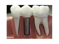 Artident, zobozdravstvene storitve (5) - Дантисты