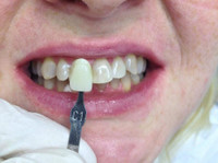 Artident, zobozdravstvene storitve (6) - Дантисты