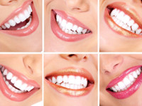 Artident, zobozdravstvene storitve (8) - Зъболекари