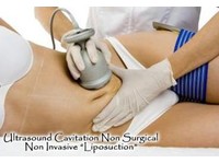 MySliM Beauty Salon - Non-surgical Ultrasound Liposuction (5) - Benessere e cura del corpo