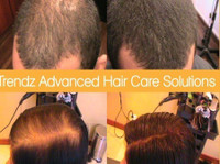 Trendz Advanced Hair Care Solutions (2) - Medicina alternativa