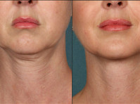 Laser Skin Care Clinic Dubai (5) - Cosmetic surgery