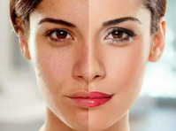 Laser Skin Care Clinic Dubai (8) - Kauneusleikkaus