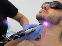Laser hair removal in abu d, Laser skin Care (1) - Tratamente de Frumuseţe