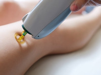 Laser hair removal in abu d, Laser skin Care (2) - Beauty Treatments