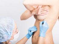 Breast Lift Surgery in Dubai (7) - Cosmetische chirurgie