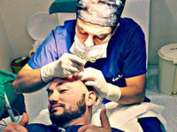 Global Health – زراعة الشعر في تركيا (1) - Cirurgia plástica