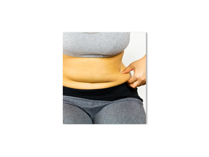 Liposuction makes you look fit and healthy - Cosmetic surgery