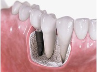 Dentists in Dubai (5) - Санитарное Просвещение