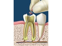 Dentists in Dubai (6) - Terveysopetus
