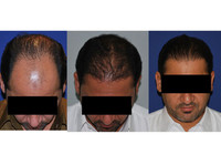Hair Transplant Clinic Dubai (1) - ہاسپٹل اور کلینک