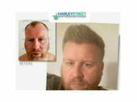Harley Street Hair Transplant Clinic London (2) - Zabiegi kosmetyczne