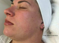 The Skin and Body Clinic (3) - Tratamente de Frumuseţe
