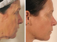 The Skin Repair Clinic (2) - Tratamente de Frumuseţe
