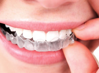 Full Dental Implants - Thorndent Dental care Center (1) - Zubní lékař