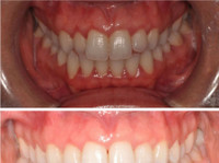 Smylife (1) - Dentistes