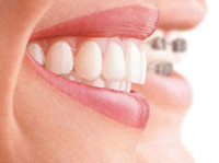 Jiva Dental (1) - Zubní lékař