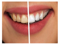 Jiva Dental (6) - Dentistas