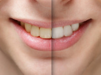 Bishopsgate Dental Care (4) - ڈینٹسٹ/دندان ساز