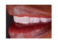 Premium Dental Turkey (3) - ڈینٹسٹ/دندان ساز