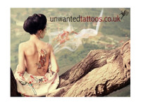 Unwanted Tattoos - Laser Tattoo Removal Specialist (2) - Салоны Красоты