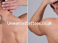 Unwanted Tattoos - Laser Tattoo Removal Specialist (3) - Салоны Красоты