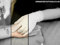 Unwanted Tattoos - Laser Tattoo Removal Specialist (5) - Козметични процедури