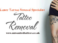 Unwanted Tattoos - Laser Tattoo Removal Specialist (6) - Третмани за убавина
