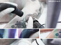 Unwanted Tattoos - Laser Tattoo Removal Specialist (7) - Салоны Красоты